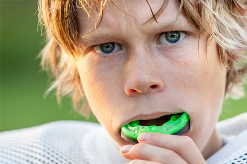 Athletic Mouthguards Are Essential For Spring Sports